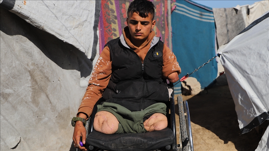 فریاد بی‌صدای رائد در چادرهای غزه: گرسنگی سخت‌تر از قطع عضو است