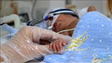 Van'daki üniversite hastanesinde geçen yıl 329 prematüre bebek tedavi edildi