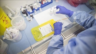 Španski istraživači eliminisali tumore pankreasa kod miševa bez razvoja otpornosti