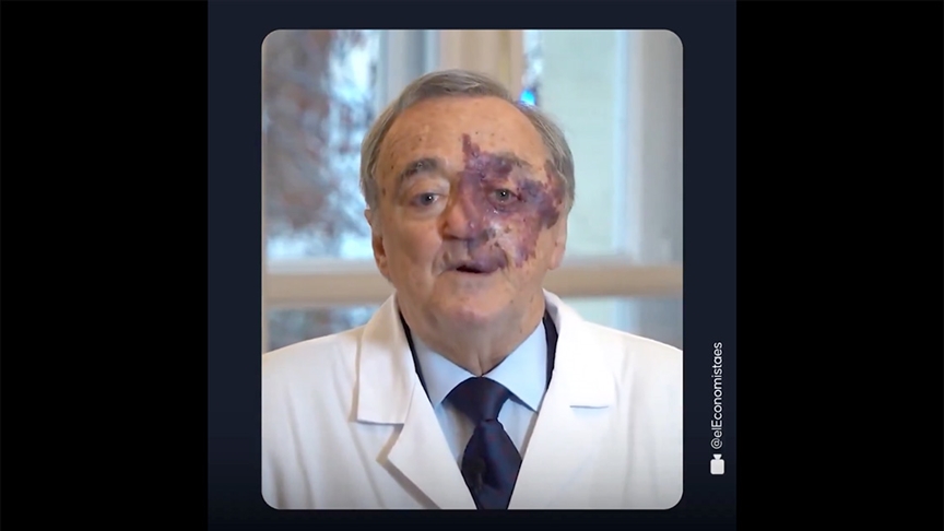 Farelerdeki pankreas kanserini tedavi eden araştırmacılara klinik deneyler için en az 30 milyon avro gerekiyor