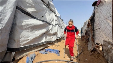 Vajza palestineze humbi familjen dhe këmbën në sulmin e Izraelit në Gaza, ëndërron të ecë përsëri