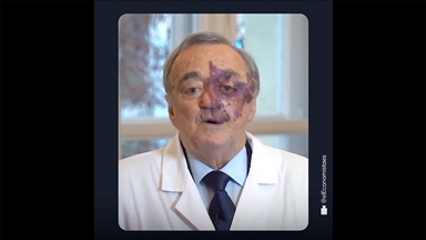 Farelerdeki pankreas kanserini tedavi eden araştırmacılara klinik deneyler için en az 30 milyon avro gerekiyor