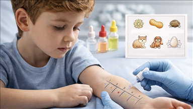 Araştırmaya göre, her 20 çocuktan birinde 6 yaşına kadar gıda alerjisi görülebilir