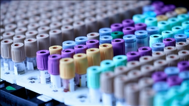 Evcil kedilerdeki kanser araştırmalarının, insanların tedavisinde umut olabileceği bildirildi