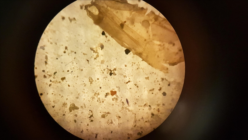 Studim  Mikroplastika gjendet tek 9 nga 10 burra të diagnostikuar me kancer të prostatës