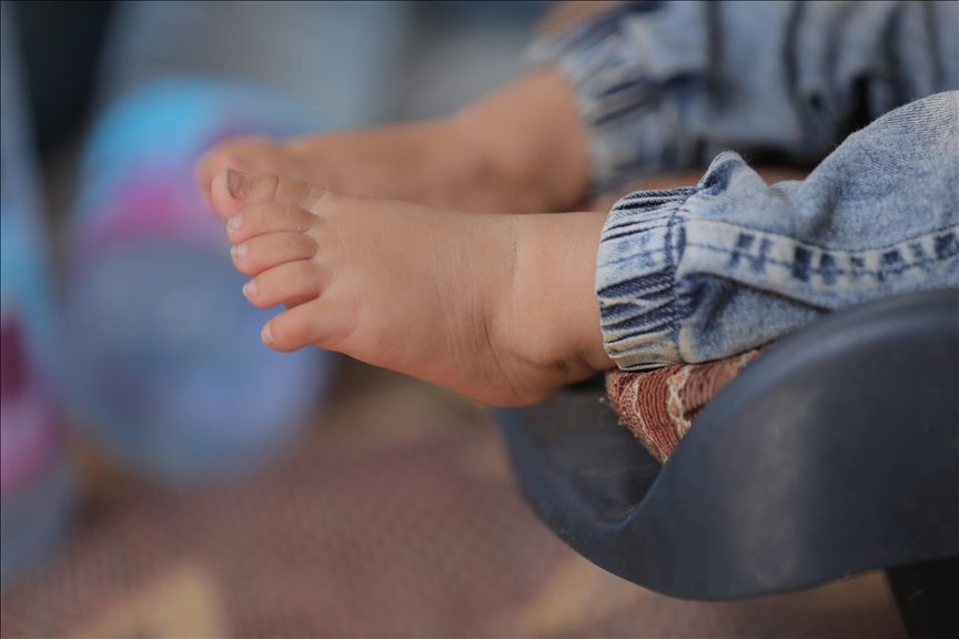 Pakistan reports its 1st polio case of 2026