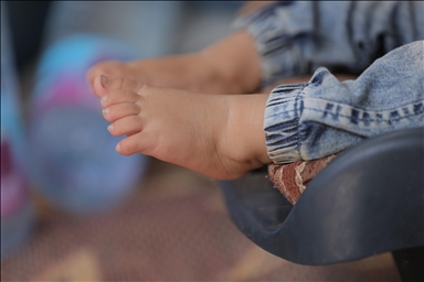 Pakistan reports its 1st polio case of 2026