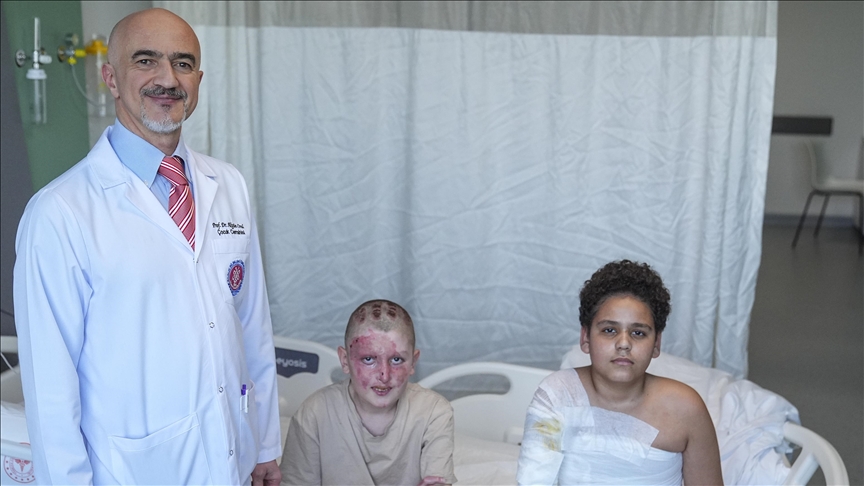 Vücutlarının yüzde 40'ında yanık oluşan çocuklar yaralarını arkadaşlıkla sardı