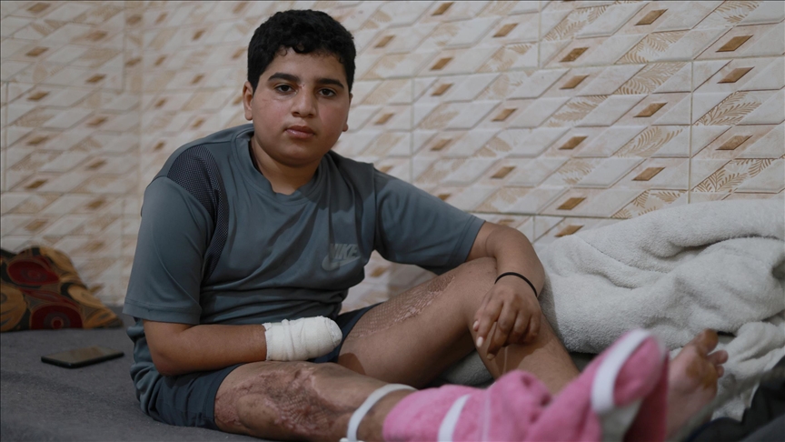 İsrail'in geride bıraktığı mühimmatla engelli kalan Gazzeli Muhammed: "Başka çocuklar benim gibi olmasın"