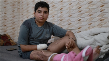 İsrail'in geride bıraktığı mühimmatla engelli kalan Gazzeli Muhammed: "Başka çocuklar benim gibi olmasın"