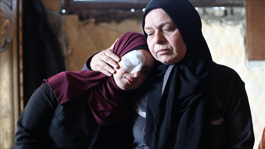 Humbi syrin në sulmin izraelit  e reja nga Gaza vazhdon të pikturojë pavarësisht aftësisë së kufizuar