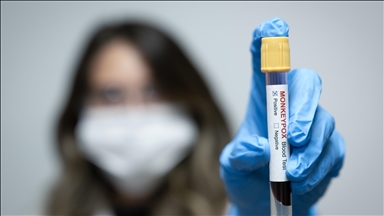 Contact tracing launched after mpox claims lives of 4 children in southern Pakistan