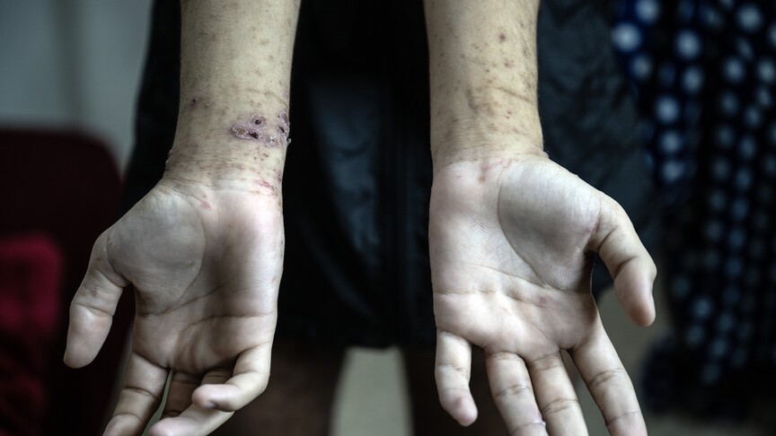 Filistin İnsan Hakları Merkezi: Filistinli esirlere yönelik ihlallerde benzeri görülmemiş artış var