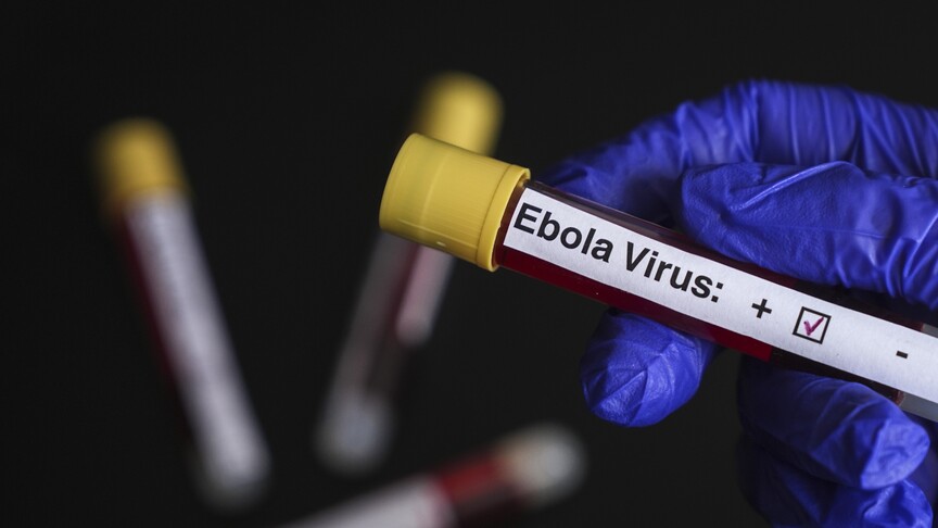 Kongo Demokratik Cumhuriyeti'nde 900'den fazla şüpheli Ebola vakasının görüldüğü bildirildi