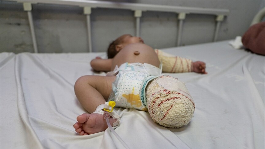 Gazze’de annesini emerken vurulan 50 günlük Muhammed bebek, annesi ve bacağından sonra elini de kaybedebilir