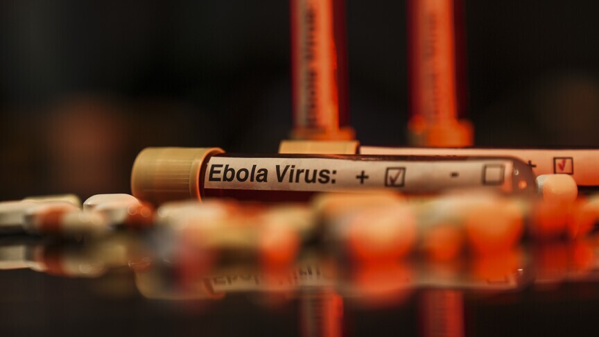 DSÖ, Uganda'da şimdiye kadar 19 Ebola virüsü vakasının görüldüğünü bildirdi