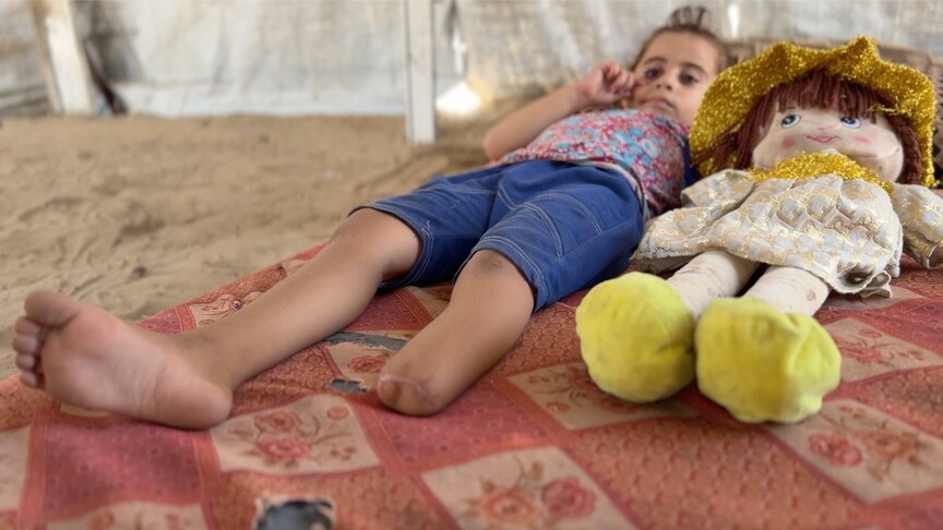 İsrail saldırısıyla hayallerini kaybeden Filistinli küçük kız, kopan bacağını fotoğraflarda arıyor