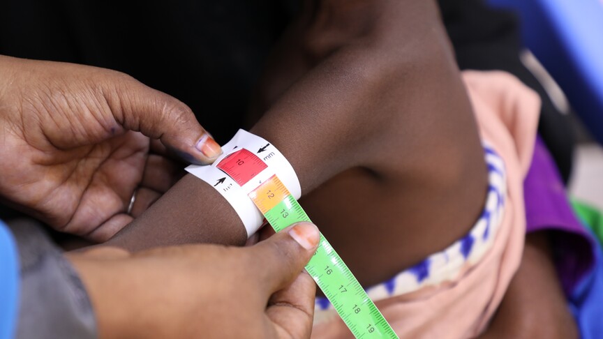 UNICEF, insani yardımların kesildiği Somali'de en büyük bedeli çocukların ödediğini bildirdi