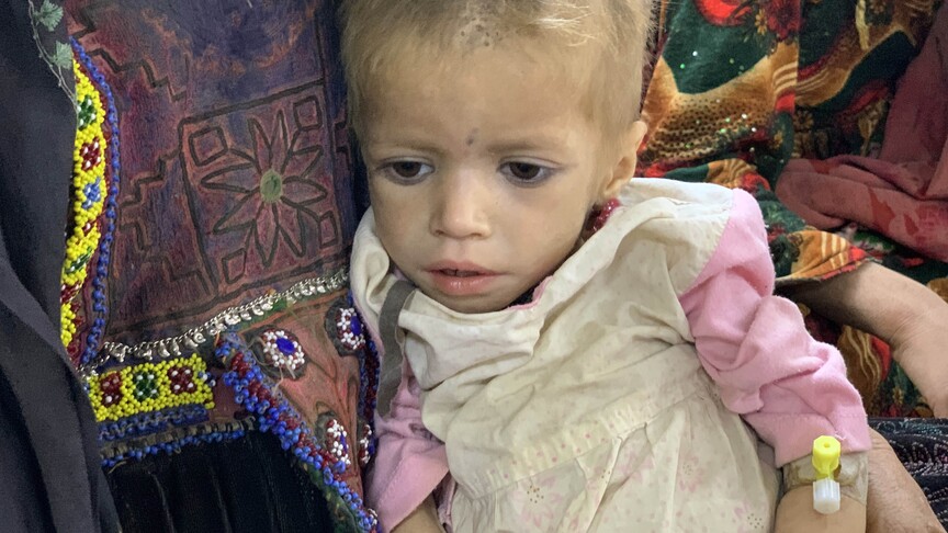 UNICEF, Afganistan'da 3,7 milyon çocuğun yetersiz beslenme nedeniyle acı çektiğini bildirdi