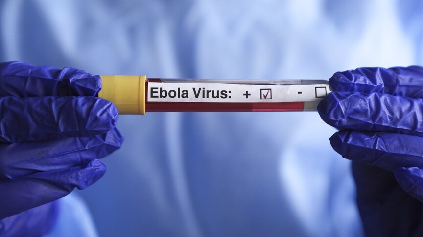 DSÖ, KDC'de Ebola salgınının büyümeye ve can almaya devam ettiğini bildirdi