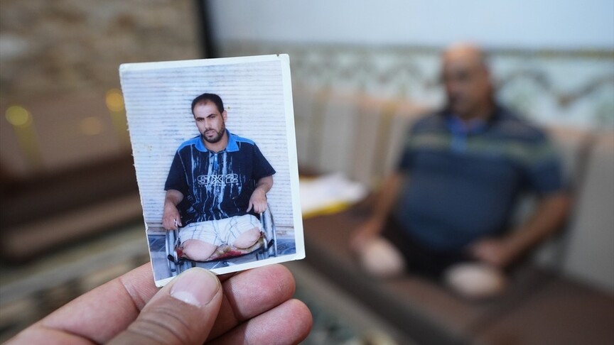 ABD ordusunun çekildiği Irak'ta siviller kaybettikleri uzuvlar ve işgalin travmasıyla yaşıyor
