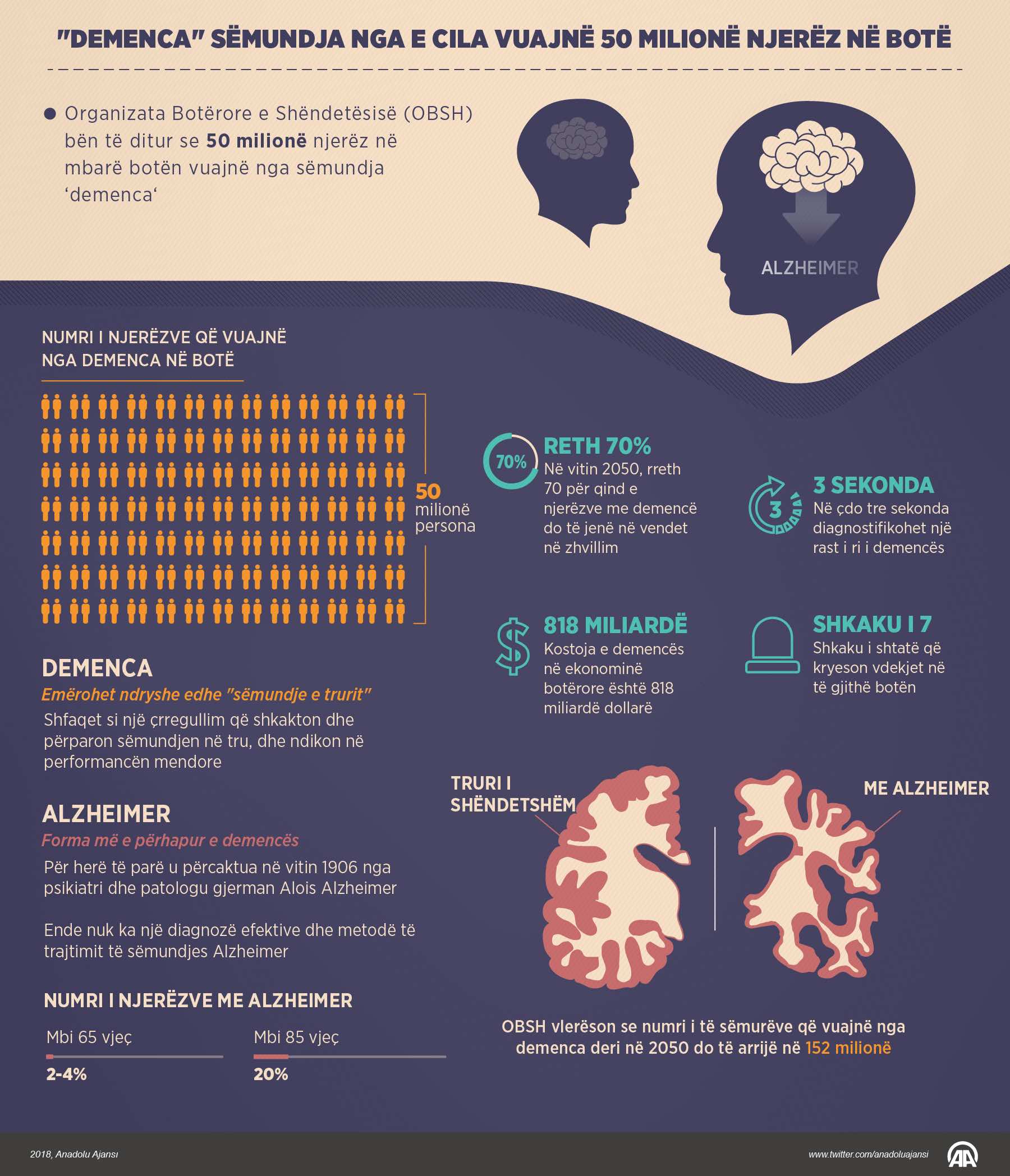 "Demenca" sëmundja nga e cila vuajnë 50 milionë njerëz në botë