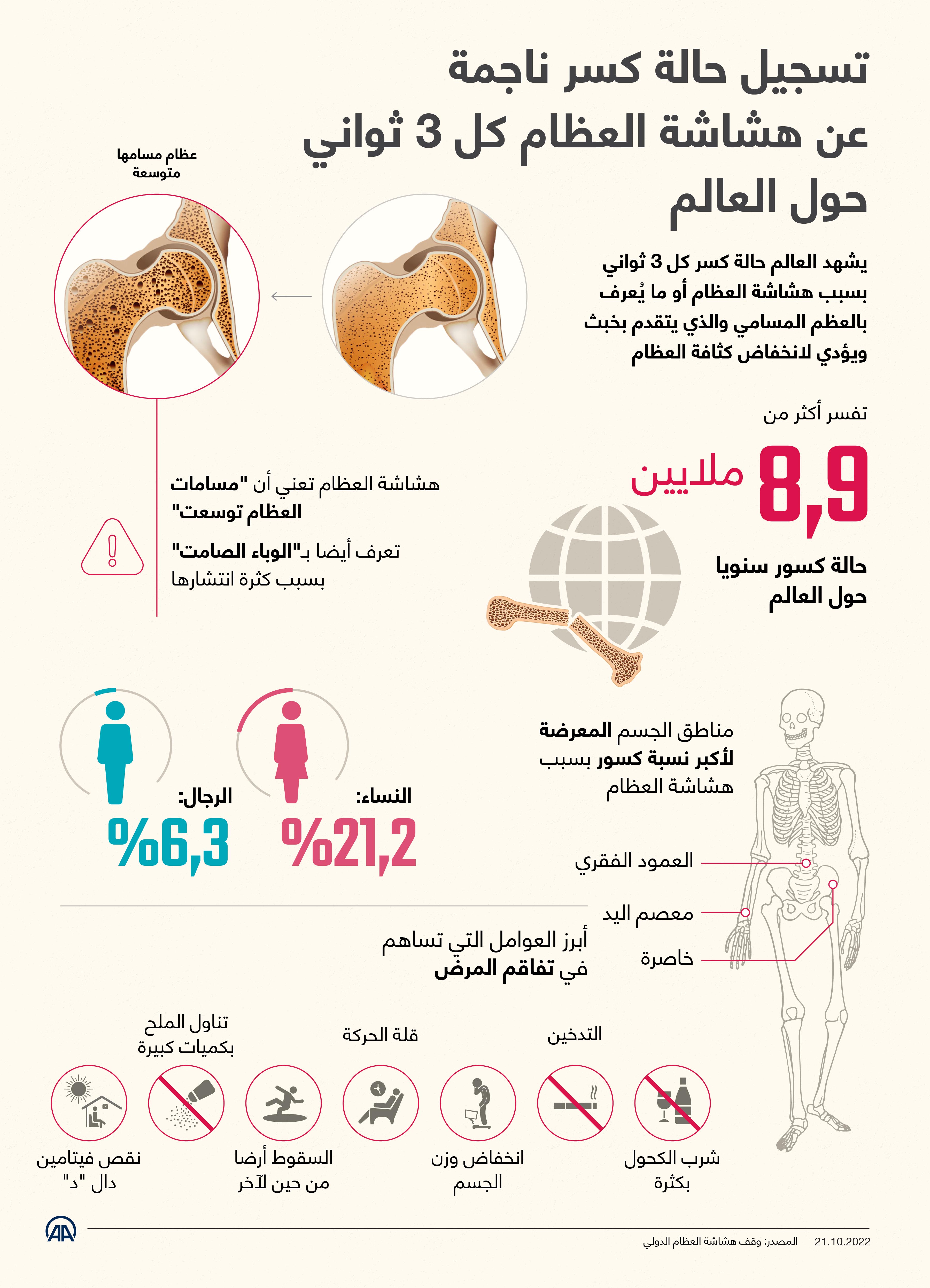 تسجيل حالة كسر ناجمة عن هشاشة العظام كل 3 ثواني حول العالم 