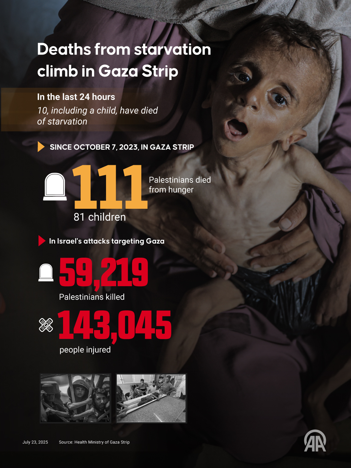 10 more Palestinians died of starvation and malnutrition in the Gaza Strip in the last 24 hour