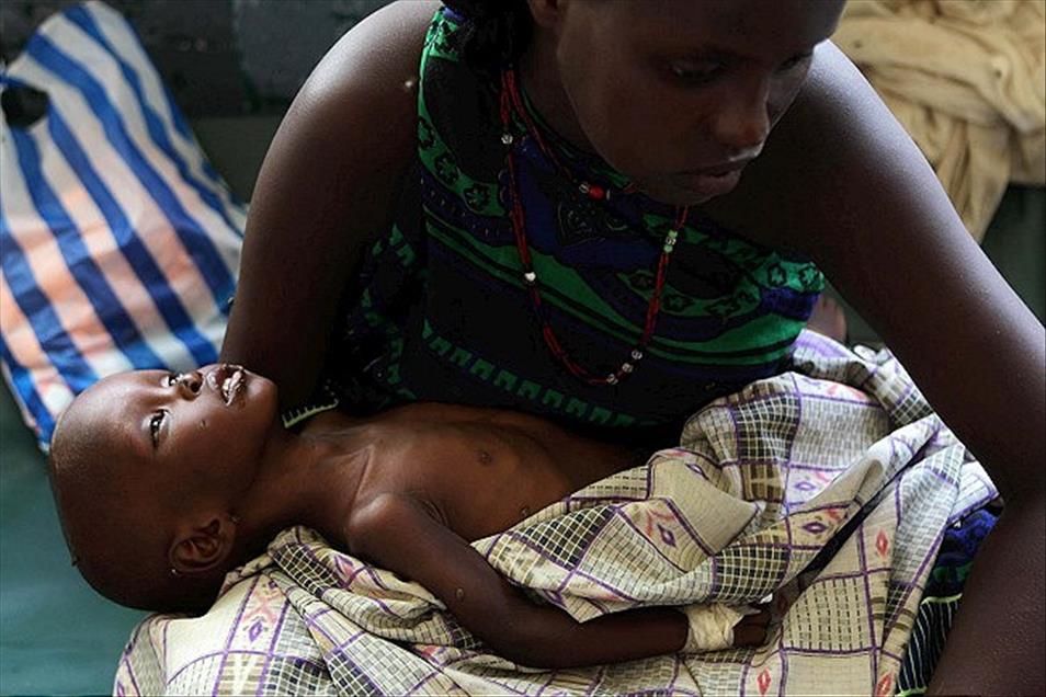 SOMALI'DE COCUKLAR OLUME DIRENIYOR