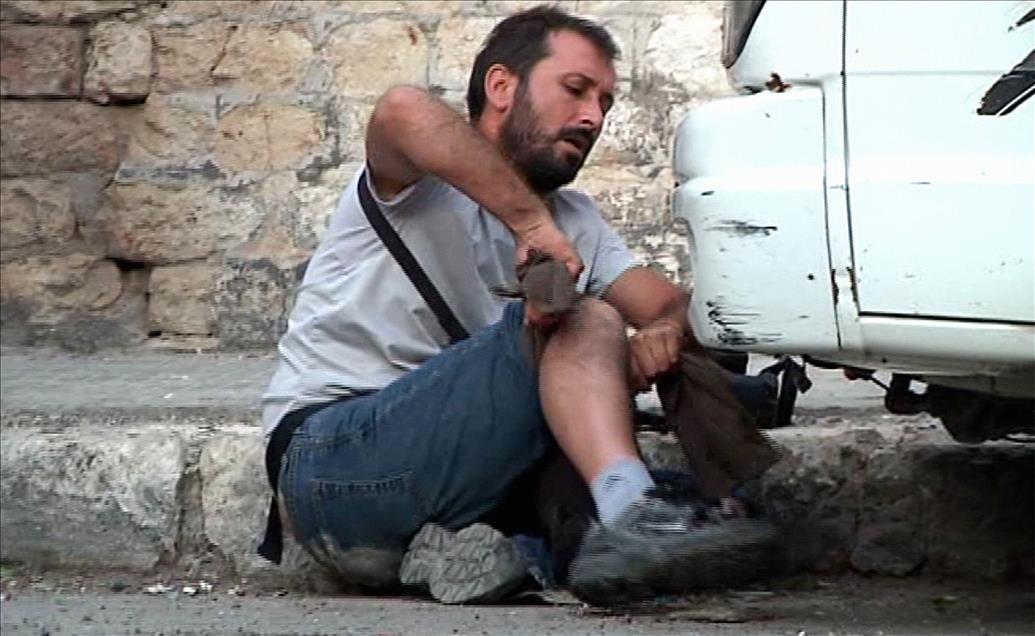 AA FOTOMUHABIRI GUL' UN HALEP' TE YARALANMASI