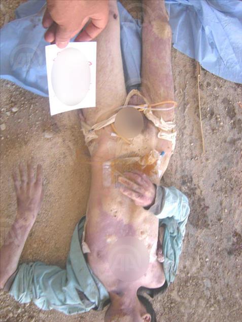 Anadolu dévoile des photos montrant la torture pratiquée par le régime syrien