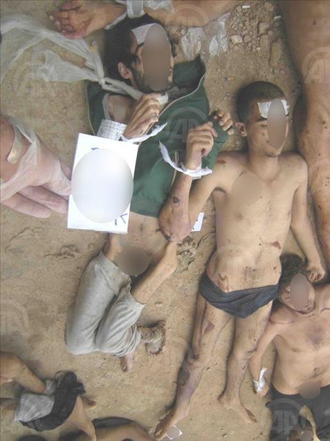 Anadolu dévoile des photos montrant la torture pratiquée par le régime syrien