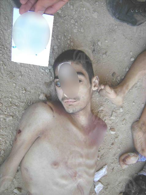 Anadolu dévoile des photos montrant la torture pratiquée par le régime syrien