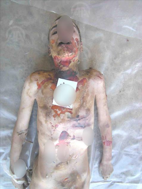 Anadolu dévoile des photos montrant la torture pratiquée par le régime syrien