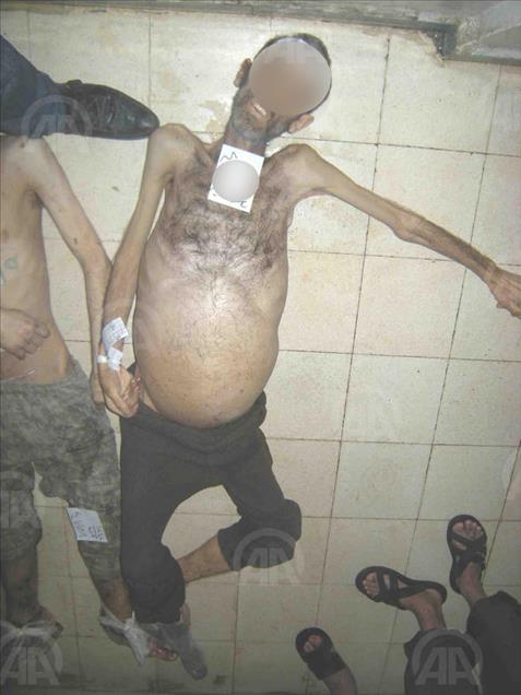 Anadolu dévoile des photos montrant la torture pratiquée par le régime syrien