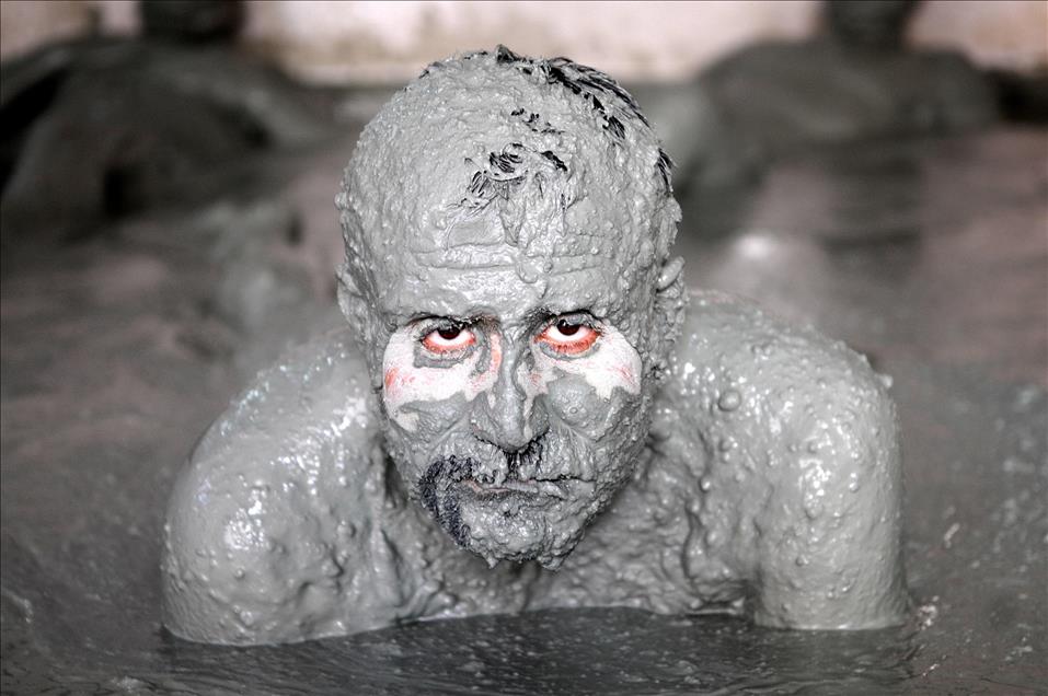 Mud Bath Treatment in Turkey's Bingol Province