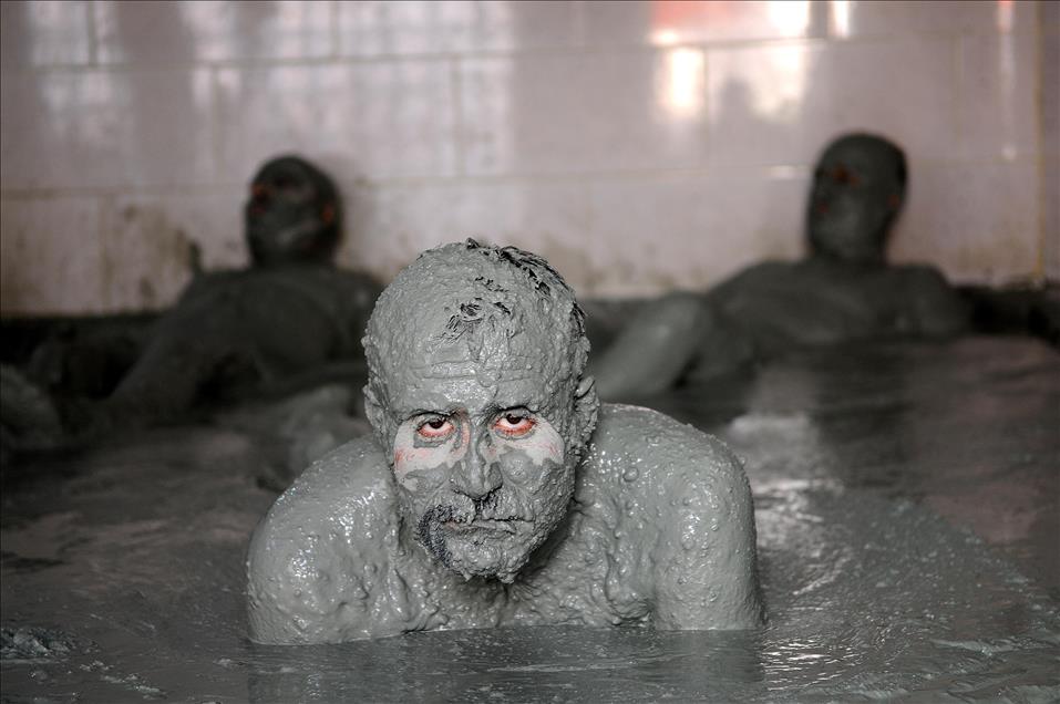 Mud Bath Treatment in Turkey's Bingol Province