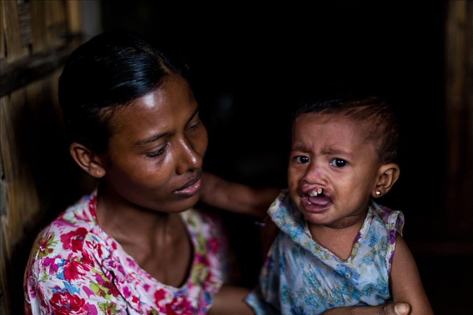 Stateless Rohingya in Sittwe IDP Camps