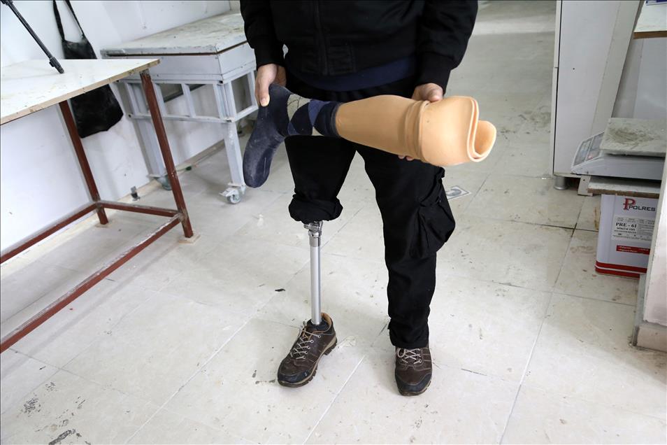 Savaşın parçaladığı bedenlere protez desteği