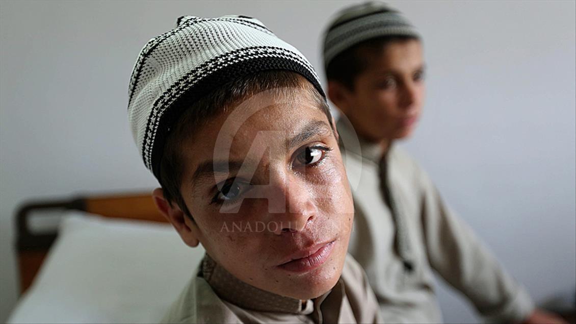 ISLAMABAD, PAKISTAN - MAY 6: Two siblings Abdul Rasheed (L) and