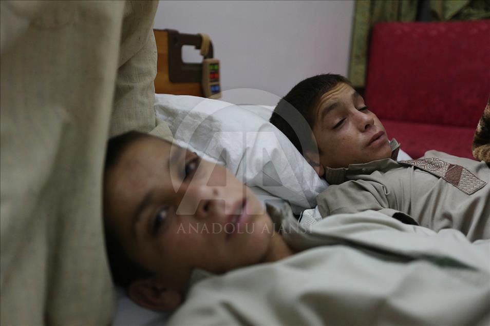2 Pakistani siblings who become paralyzed each night