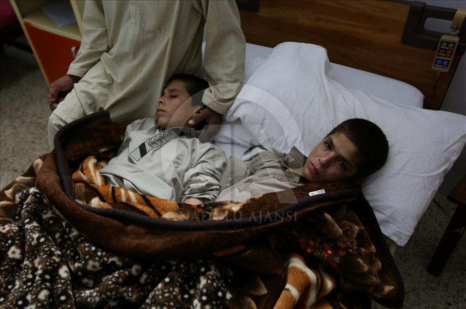 2 Pakistani siblings who become paralyzed each night