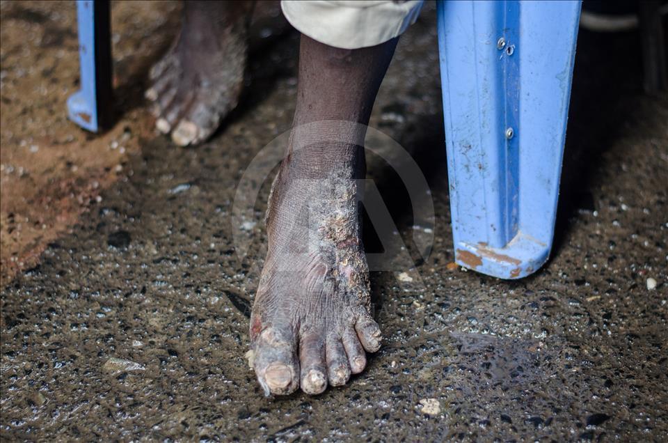 Kenya'da 600 kimsesiz çocuk iki katlı yetimhanede kalıyor