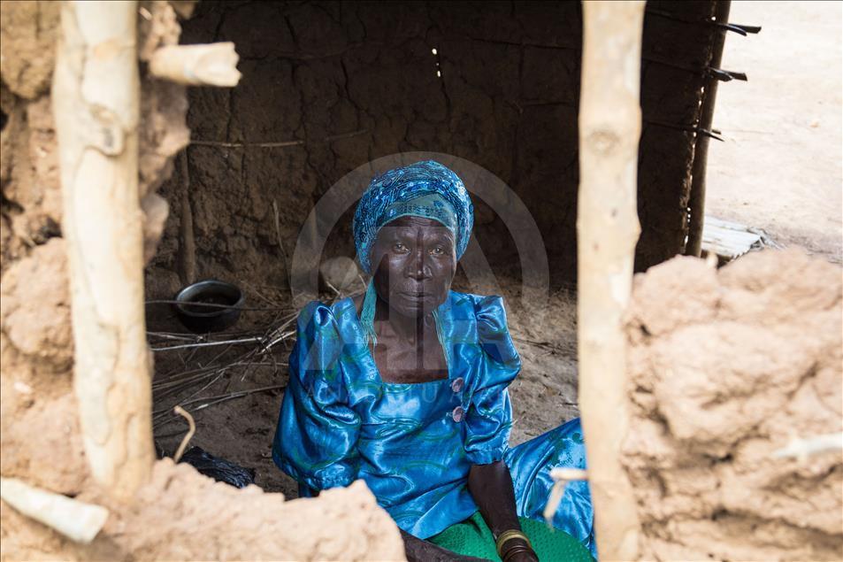 Ugandalı çift yıllar sonra yeniden görmeye başladı