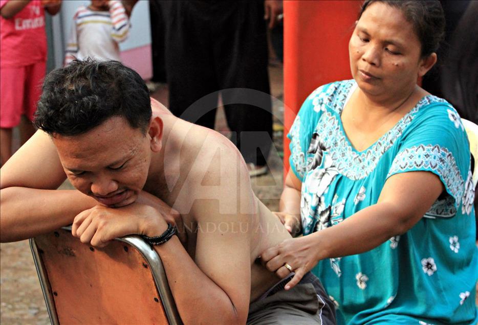 Endonezya'da soğuk algınlığına "bozuk paralı" tedavi
