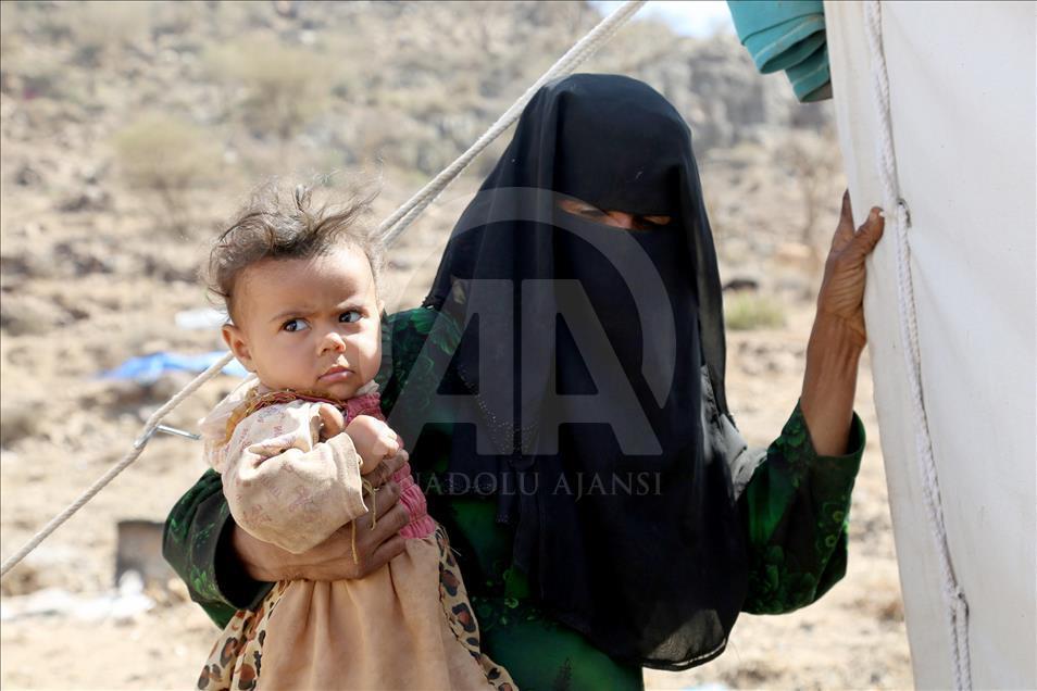 Arap Yarımadası'nın en yoksul ülkesi Yemen'de "iç göç dramı"