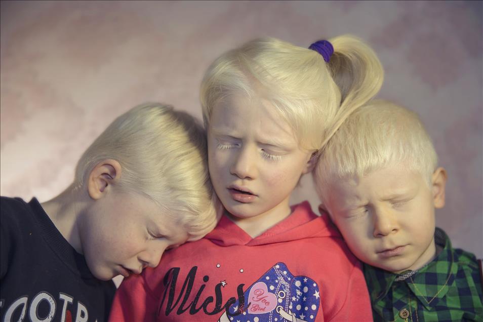 Albinos of Turkey