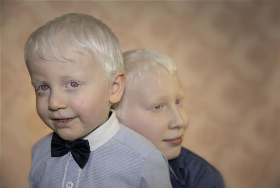 Albinos of Turkey