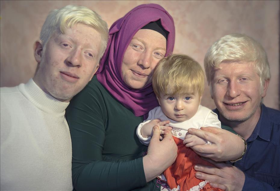 Albinos of Turkey