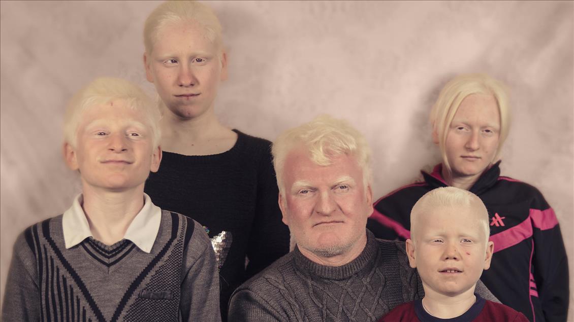 Albinos of Turkey